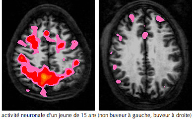 Buveur15Cerveau.jpg