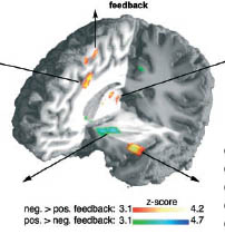 MetacognitionCerveau.jpg